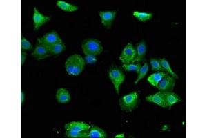 Immunofluorescent analysis of HepG2 cells using ABIN7153147 at dilution of 1:100 and Alexa Fluor 488-congugated AffiniPure Goat Anti-Rabbit IgG(H+L)