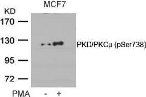 Western blot analysis of extracts from MCF cells untreated or treated with PMA using PKD/PKCm(Phospho-Ser738) Antibody.