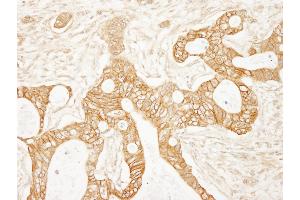 Immunohistochemistry (IHC) image for anti-Catenin, beta (CATNB) (AA 710-760) antibody (ABIN7453664)