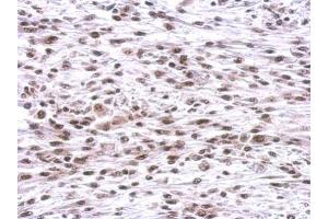IHC-P Image CBX1 / HP1 beta antibody detects CBX1 protein at nucleus on C2C12 xenograft by immunohistochemical analysis.