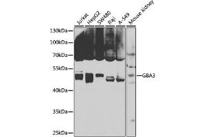 Western blot analysis of extracts of various cell lines, using GB antibody (ABIN6131369, ABIN6140990, ABIN6140991 and ABIN6223796) at 1:1000 dilution.
