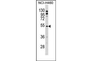 Image no. 1 for anti-B-Cell Linker (BLNK) (Middle Region) antibody (ABIN452784) (B-Cell Linker anticorps  (Middle Region))