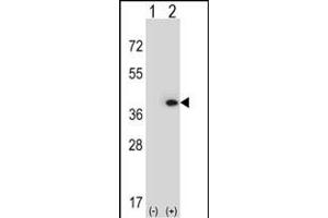 Western blot analysis of MLF1 (arrow) using rabbit polyclonal MLF1 Antibody (N-term) (ABIN390672 and ABIN2840967). (MLF1 anticorps  (N-Term))