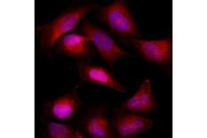 Immunofluorescenitrocellulosee of HeLa cells stained with Hoechst 3342 (Blue) for nucleus staining and with monoclonal anti-human Bcl-2 antibody (1:500) with Texas Red (Red). (Bcl-2 anticorps  (AA 1-211))