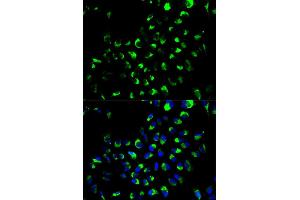 Immunofluorescence analysis of A549 cells using AK4 antibody (ABIN6290046). (AK4 anticorps)