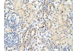 Image no. 1 for anti-Transmembrane Emp24 Protein Transport Domain Containing 4 (TMED4) (N-Term) antibody (ABIN202093)