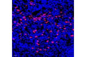 Immunofluorescence of paraffin embedded mouse spleen using IL-23R (ABIN7074355) at dilution of 1:200 (400x lens)