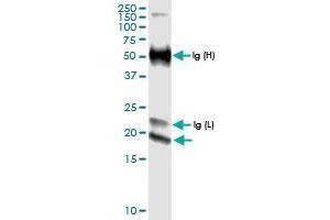 IFNE (Human) IP-WB Antibody Pair