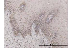 Immunoperoxidase of monoclonal antibody to SAP30 on formalin-fixed paraffin-embedded human esophagus.