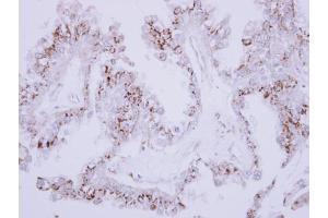 anti-ST6 beta-Galactosamide alpha-2,6-Sialyltranferase 1 (ST6GAL1) (Center) antibody