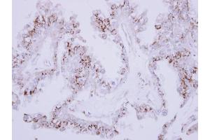 IHC-P Image Immunohistochemical analysis of paraffin-embedded OVCA xenograft, using CD75, antibody at 1:500 dilution. (ST6GAL1 anticorps  (Center))