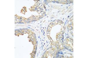 Immunohistochemistry of paraffin-embedded human prostate using CBL antibody (ABIN1871485) at dilution of 1:200 (40x lens). (CBL anticorps)