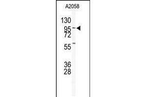 Western blot analysis of anti-USP5 Antibody in A2058 cell line lysates (35ug/lane) (USP5 anticorps  (N-Term))