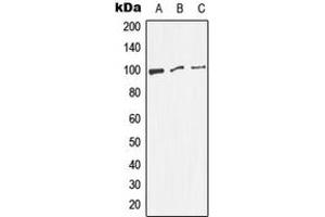 Western blot analysis of Dynamin 1 (pS774) expression in HeLa (A), NIH3T3 (B), PC12 (C) whole cell lysates. (Dynamin 1 anticorps  (C-Term, pSer774))