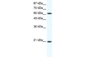 WB Suggested Anti-Anxa6 Antibody Titration:  1. (ANXA6 anticorps  (C-Term))