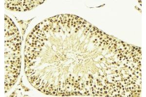 ABIN6269376 at 1/100 staining Mouse testis tissue by IHC-P. (CAMK4 anticorps  (Internal Region))