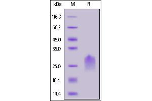 Human PVRIG, His Tag on  under reducing (R) condition.