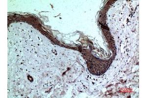 Immunohistochemistry (IHC) analysis of paraffin-embedded Human Skin, antibody was diluted at 1:100. (IL-8 anticorps  (C-Term))