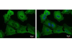 ICC/IF Image USP8 antibody detects USP8 protein at cytoplasm by immunofluorescent analysis.