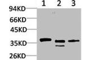 Western blot analysis of 1) Human Brain Tissue, 2) Mouse Brain Tissue, 3) Rat Brain Tissue using CACNG2 Polyclonal Antibody.