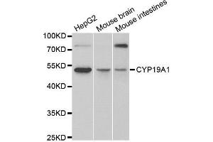 Western blot analysis of extracts of various cell lines, using CYP19A1 antibody. (Aromatase anticorps)