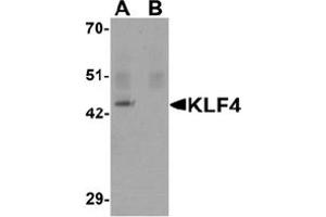 Image no. 1 for anti-Kruppel-Like Factor 4 (Gut) (KLF4) (C-Term) antibody (ABIN1449394) (KLF4 anticorps  (C-Term))