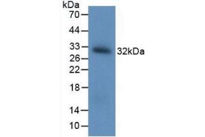 Figure. (BDNF anticorps  (AA 20-252))