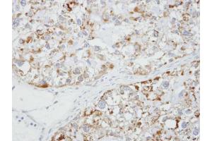 IHC-P Image Immunohistochemical analysis of paraffin-embedded OVCA xenograft, using Glycine Receptor alpha1, antibody at 1:100 dilution.