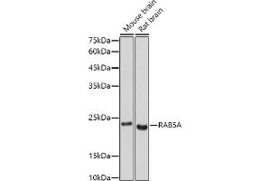 Western blot analysis of extracts of various cell lines, using RA antibody (ABIN3021646, ABIN3021647, ABIN3021648 and ABIN1513457) at 1:500 dilution. (RAB5 anticorps  (AA 1-215))