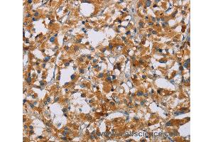 Immunohistochemistry of Human tonsil using NRN1 Polyclonal Antibody at dilution of 1:40