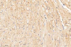 Immunohistochemistry analysis of paraffin-embedded mouse heart using,MTND1 (ABIN7074658) at dilution of 1: 1000