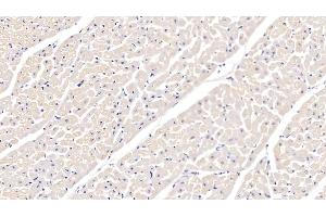Detection of ITGa5 in Bovine Cardiac Muscle Tissue using Polyclonal Antibody to Integrin Alpha 5 (ITGa5) (ITGA5 anticorps  (AA 649-900))