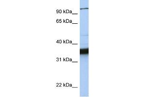 WB Suggested Anti-KIFC3 Antibody Titration:  0. (KIFC3 anticorps  (C-Term))