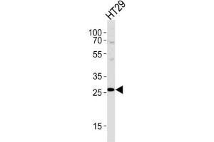 Western Blotting (WB) image for anti-Nicotinamide N-Methyltransferase (NNMT) antibody (ABIN2997531) (NNMT anticorps)
