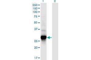 Western Blot analysis of C4orf43 expression in transfected 293T cell line by C4orf43 monoclonal antibody (M08), clone 4A6. (C4orf43 anticorps  (AA 1-203))