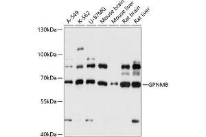 Western blot analysis of extracts of various cell lines, using GPNMB antibody (ABIN7269117) at 1:3000 dilution.