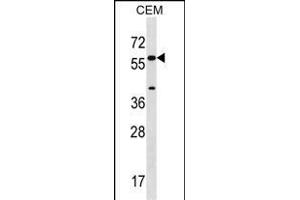 CYP21A2 Antibody (Center) (ABIN1537905 and ABIN2848684) western blot analysis in CEM cell line lysates (35 μg/lane).