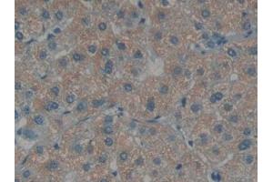 Detection of EDN1 in Human Liver Tissue using Polyclonal Antibody to Endothelin 1 (EDN1) (Endothelin 1 anticorps  (AA 53-90))