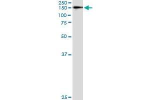 Immunoprecipitation of WWP1 transfected lysate using anti-WWP1 monoclonal antibody and Protein A Magnetic Bead , and immunoblotted with WWP1 MaxPab rabbit polyclonal antibody. (WWP1 anticorps  (AA 152-260))