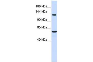 WB Suggested Anti-IGSF1 Antibody Titration:  0. (IGSF1 anticorps  (Middle Region))