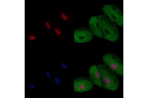 ABIN6257258 and ABIN6274281 staining  cells by IF/ICC.