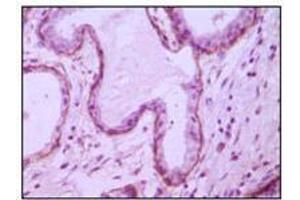 Immunohistochemical analysis of paraffin-embedded human breast ductal myoepithelium,showing cytoplasmic and membrane location with DAB staining using CD10 mouse mAb. (MME anticorps)