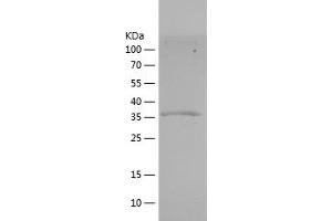 Western Blotting (WB) image for Myostatin (MSTN) (AA 267-375) protein (His-IF2DI Tag) (ABIN7124076)