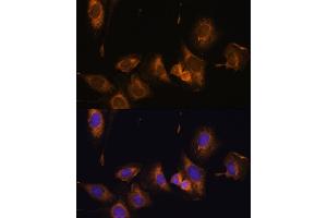 Immunofluorescence analysis of U-2 OS cells using RPL32 Polyclonal Antibody (ABIN6129104, ABIN6147138, ABIN6147139 and ABIN6216824) at dilution of 1:100 (40x lens).
