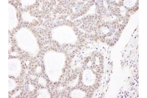 Immunohistochemistry (IHC) image for anti-Chromodomain Helicase DNA Binding Protein 3 (CHD3) (AA 1950-2000) antibody (ABIN7448475)