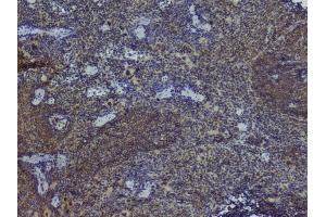 IHC analysis of NRF1 using anti-NRF1 antibody (ABIN6719347).