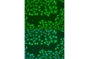 Immunofluorescence analysis of U2OS cells using SSB antibody (ABIN1874948) at dilution of 1:100. (SSB anticorps)