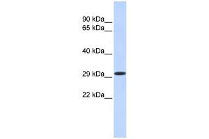 WB Suggested Anti-KLF14 Antibody Titration:  0. (KLF14 anticorps  (N-Term))