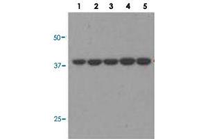 Western blot analysis of Lane 1: A549, Lane 2: H460, Lane 3: H1703, Lane 4: 293, Lane 5: HeLA with JTV1 monoclonal antibody (MAB11292) at 1:1000 dilution. (AIMP2 anticorps)