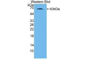 Detection of Recombinant NFIX, Rat using Polyclonal Antibody to Nuclear Factor I/X (NFIX)